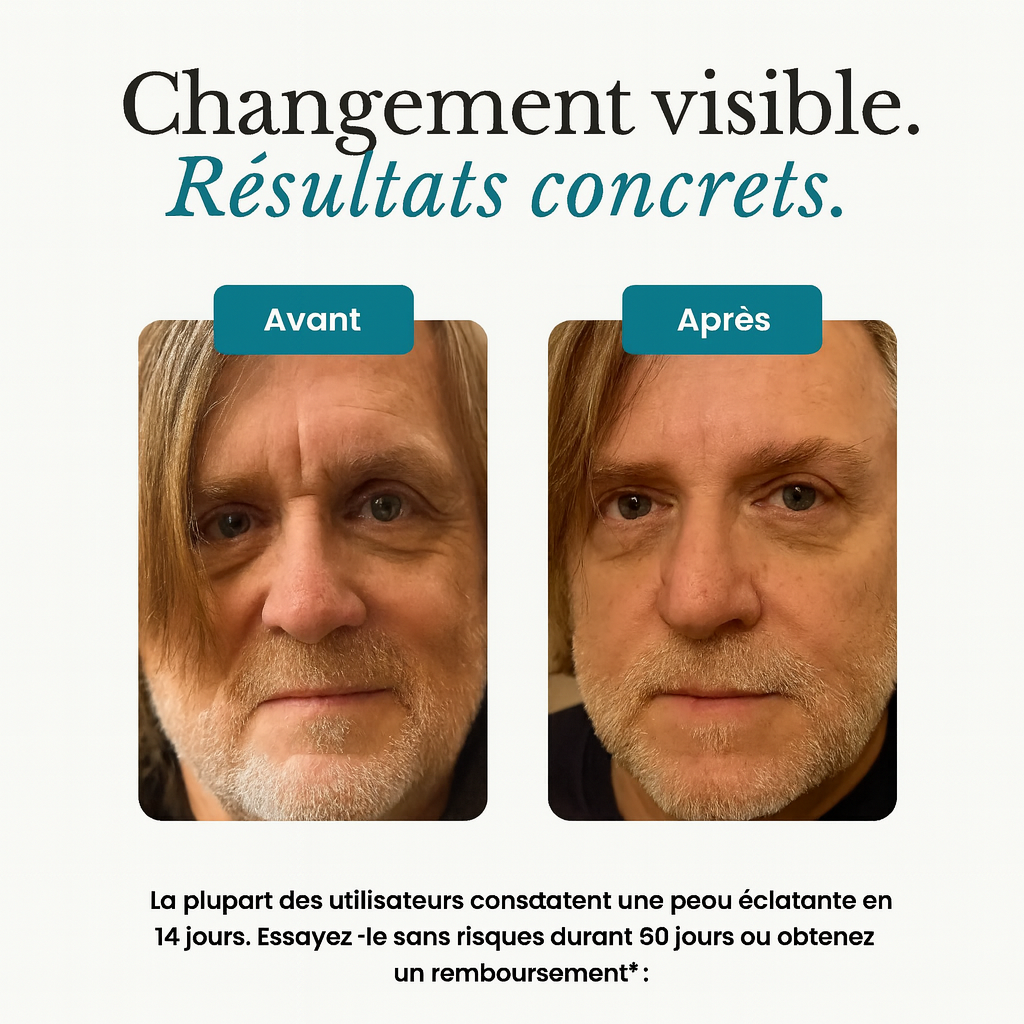 Pack Forge au suif de bœuf– Spécialement pour la peau des hommes matures RONEX