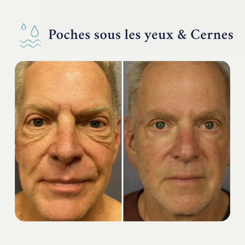 Pack Forge au suif de bœuf– Spécialement pour la peau des hommes matures RONEX