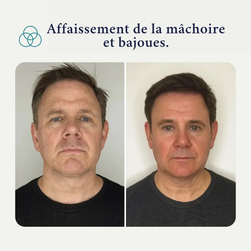 Pack Forge au suif de bœuf– Spécialement pour la peau des hommes matures RONEX