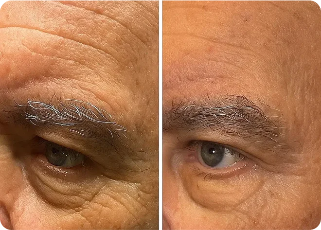 Pack Forge au suif de bœuf– Spécialement pour la peau des hommes matures RONEX