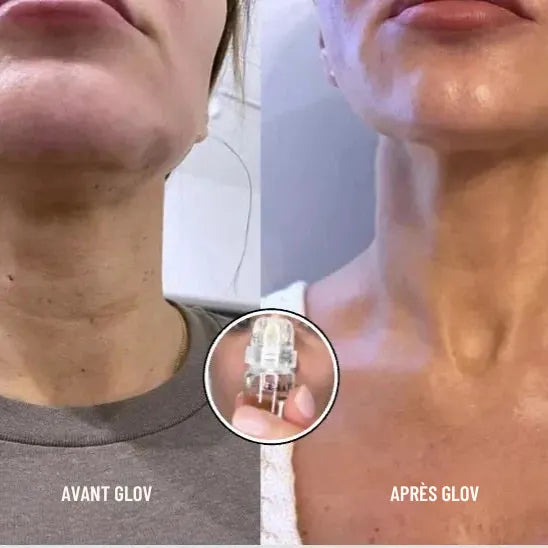 Micro infusion anti-rides