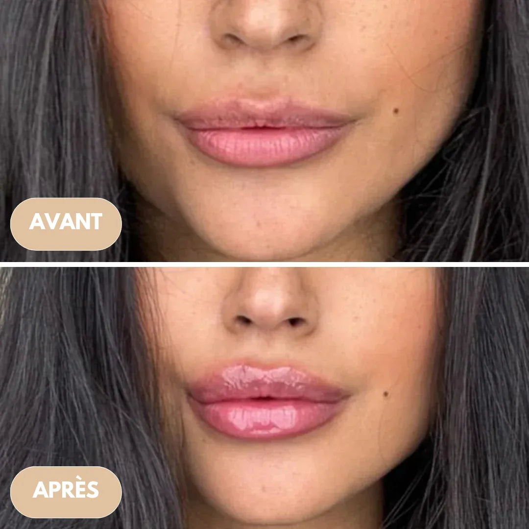 Repulpeur de lèvres