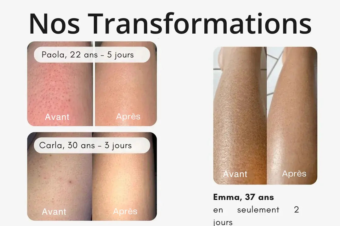 Brosse sèche High Brush™