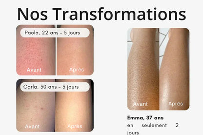 Brosse sèche High Brush™