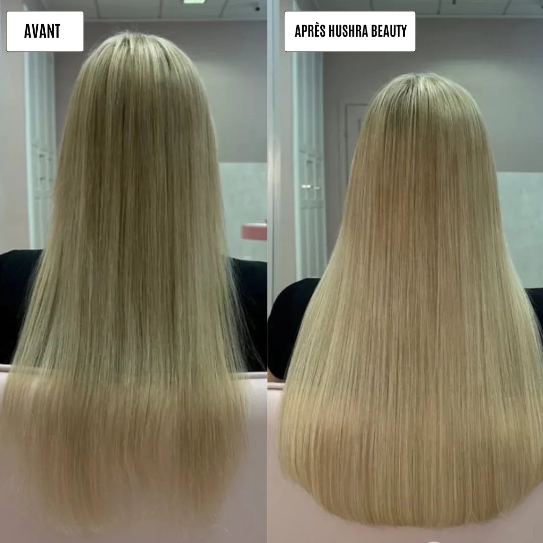 Micro infusion repousse cheveux