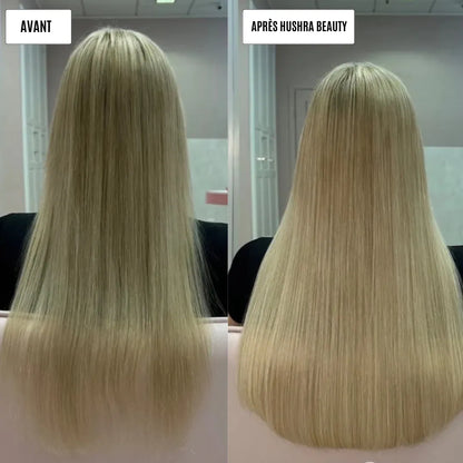 Micro infusion repousse cheveux