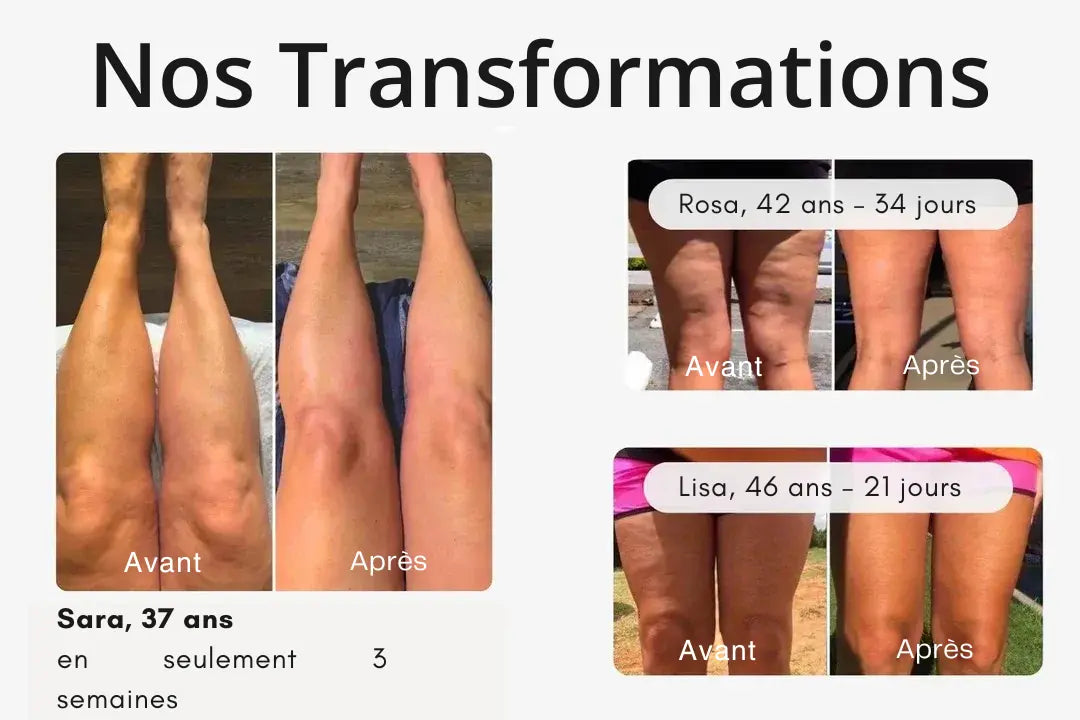 Brosse sèche High Brush™