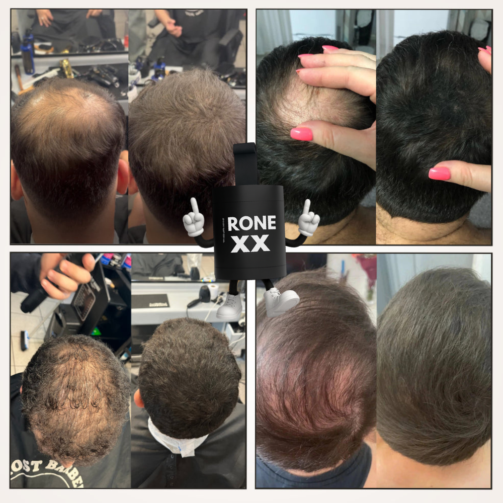 Camouflage capillaire RONEX